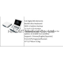 Mt Medical PC Based Ultrasound Scanner Laptop Portable Ultrasound Good Image